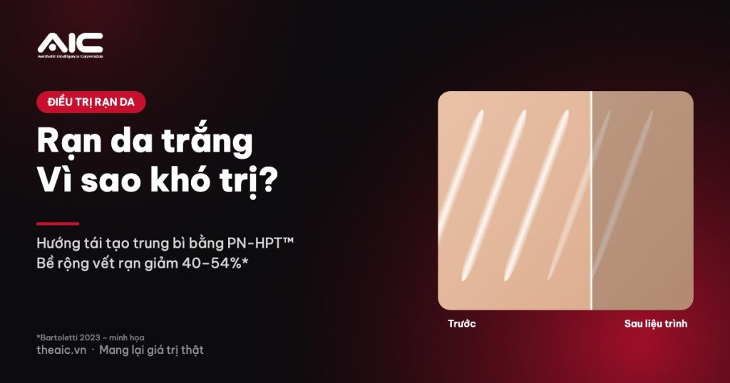 Rạn da trắng striae albae và hướng tái tạo bằng polynucleotide PN-HPT™
