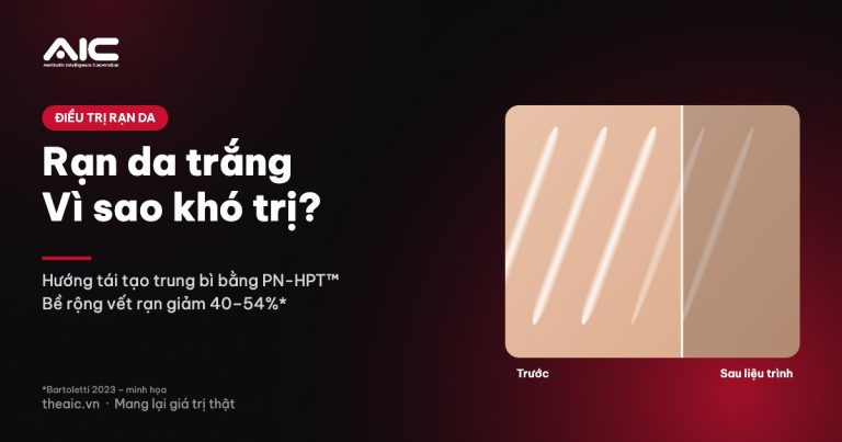 Rạn da trắng (Striae Albae): Vì sao khó trị và hướng tái tạo bằng PN-HPT™
