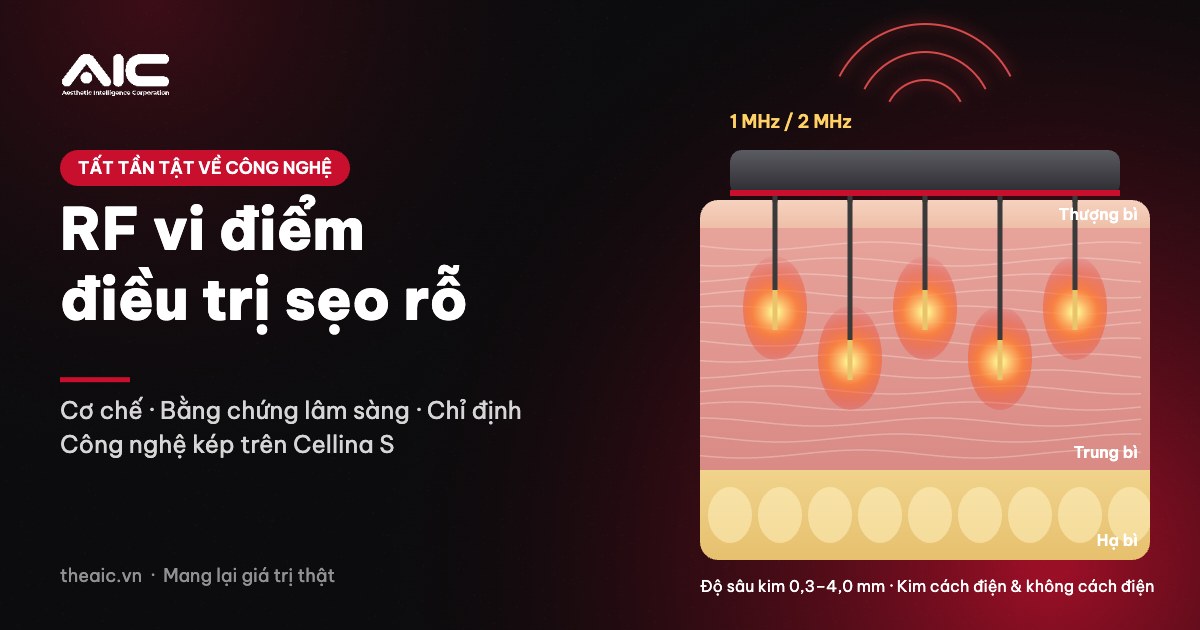 Minh họa RF vi điểm: vi kim đưa nhiệt RF vào trung bì tạo vùng đông tụ, điều trị sẹo rỗ với Cellina S